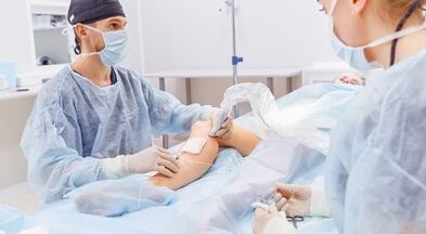 Surgery for varicose veins