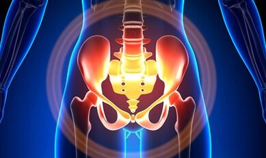 Causes of venous veins of pelvis