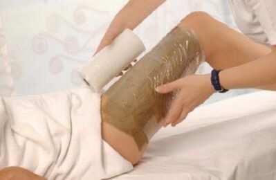 Acetic wrap has been shown to be effective for varicose veins in the legs