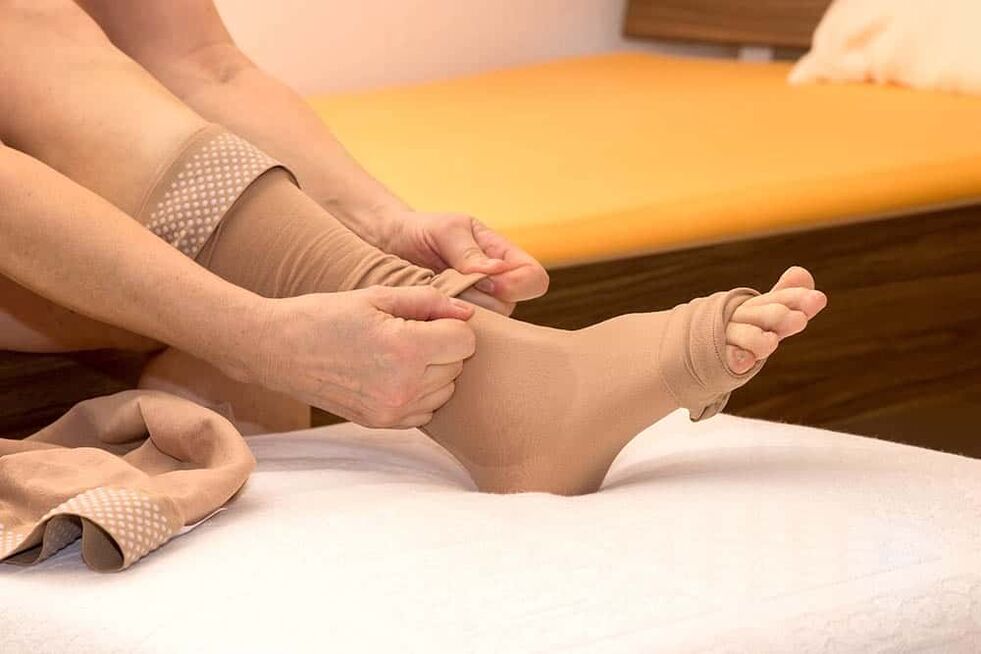 The use of compression stockings will help relieve the symptoms of varicose veins. 